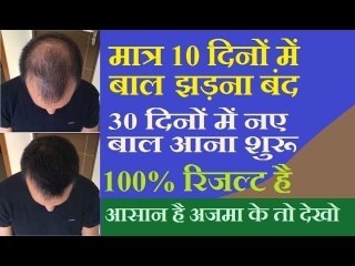 मात्र 10 दिन में बाल झड़ना बंद और 30 दिनों में नए बाल आना शुरू | 100% Solutuon