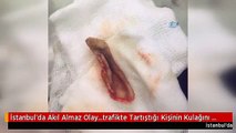 İstanbul'da Akıl Almaz Olay...trafikte Tartıştığı Kişinin Kulağını Isırarak Kopardı