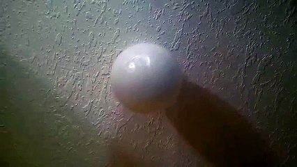 The Idiopathic Hypersomnia Brain