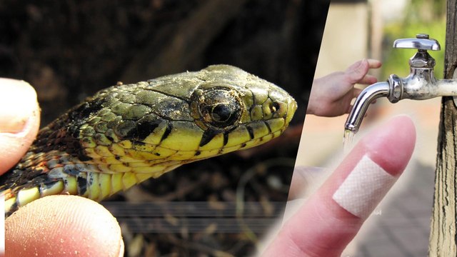 남자어린이 뱀 잡았을 때 1번, 집에서 뱀 가지고 놀려다 1번 물리고, 의식불명