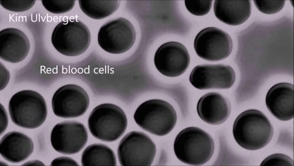 What Would Happen If You Blend Two Different Blood Types