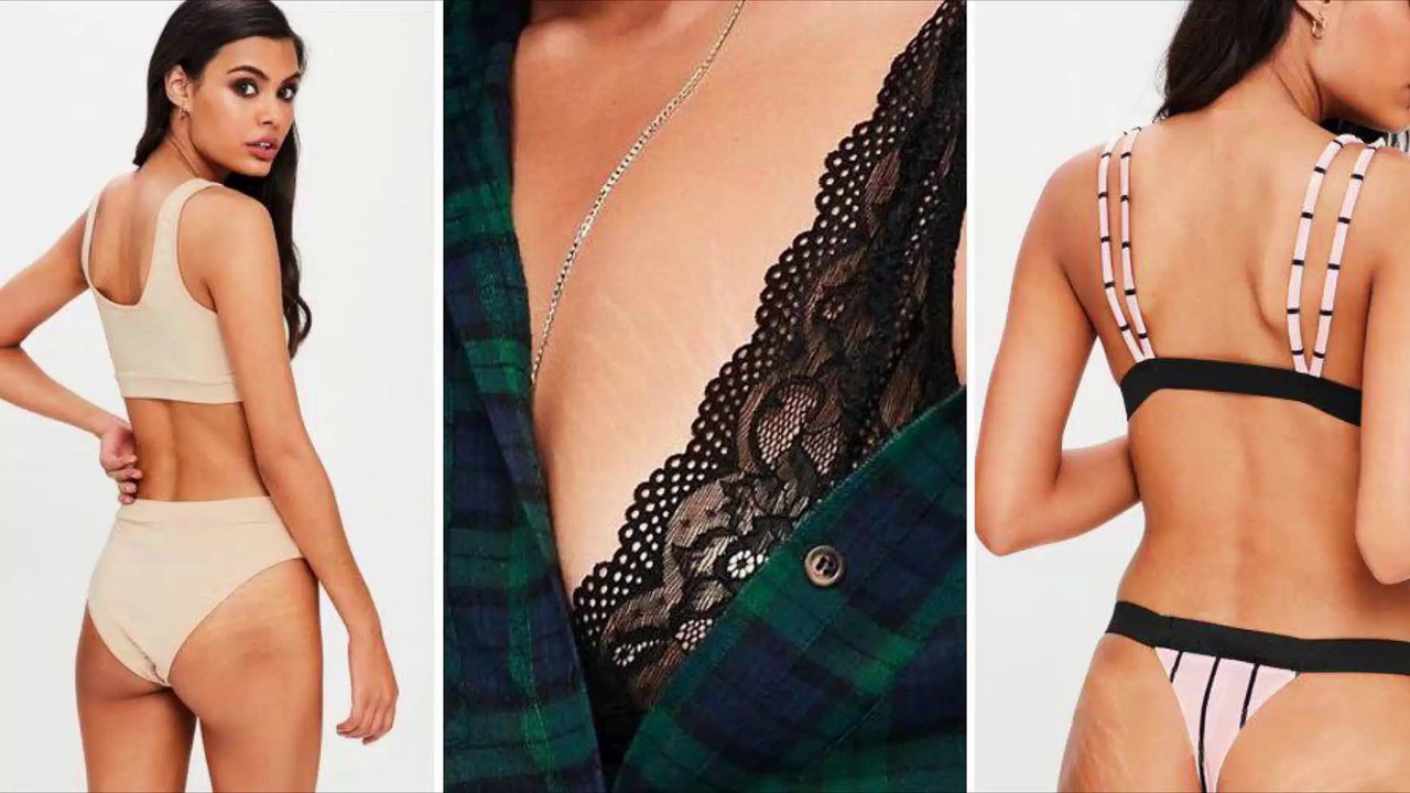 Missguided ne retouche plus les vergetures de ses mannequins