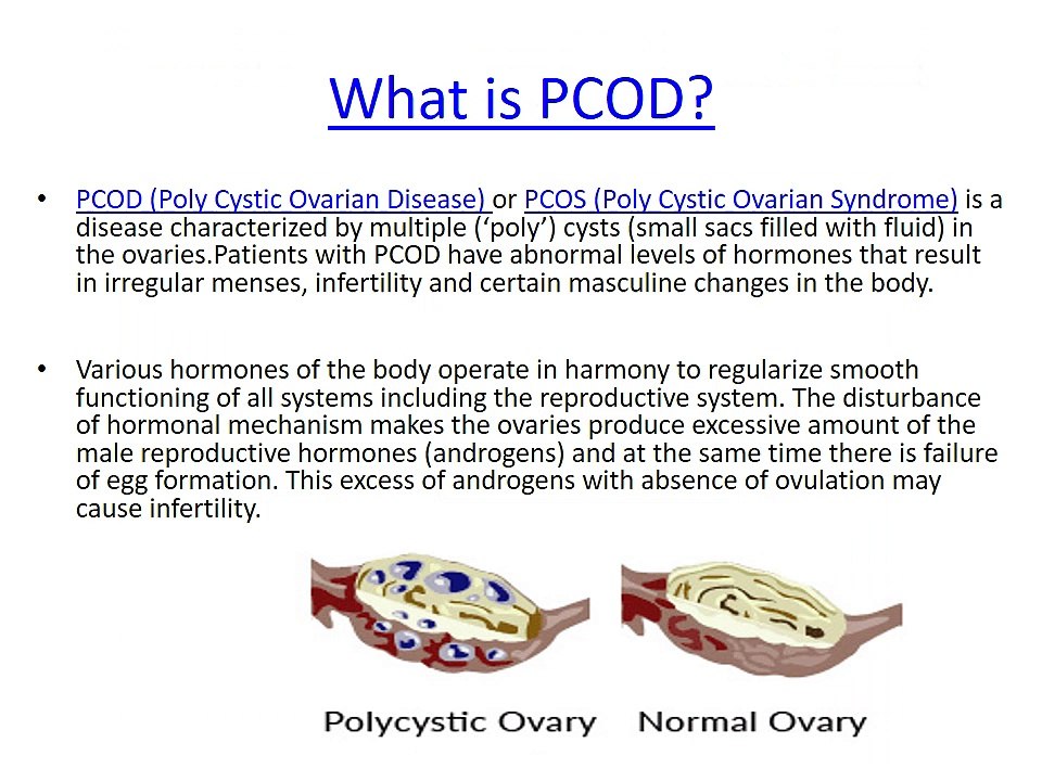 Everything you need to know about PCOD (2)