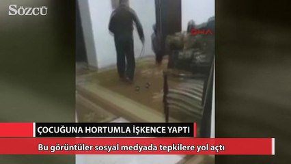 Download Video: Çocuğuna hortumla işkence yaptı