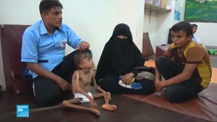 الجوع يهدد ملايين اليمنيين