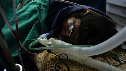 Syrie: dans la Ghouta assiégée, la débrouille des médecins