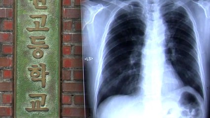 고등학교 결핵 집단 감염...수능 앞두고 불안 / YTN