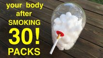 Les poumons d'un fumeur après 30 paquets de cigarettes