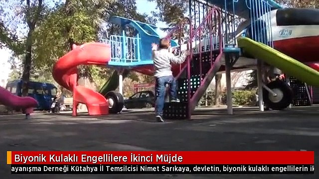 Biyonik Kulaklı Engellilere İkinci Müjde
