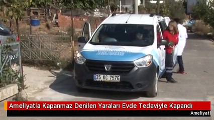 Ameliyatla Kapanmaz Denilen Yaraları Evde Tedaviyle Kapandı
