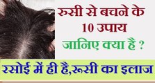 रूसी से बचने के 10 घरेलू उपाय | Home Remedy for Dandruff - How to remove dandruff from hair