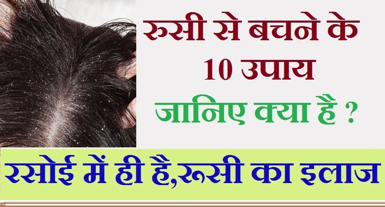 रूसी से बचने के 10 घरेलू उपाय | Home Remedy for Dandruff - How to remove dandruff from hair