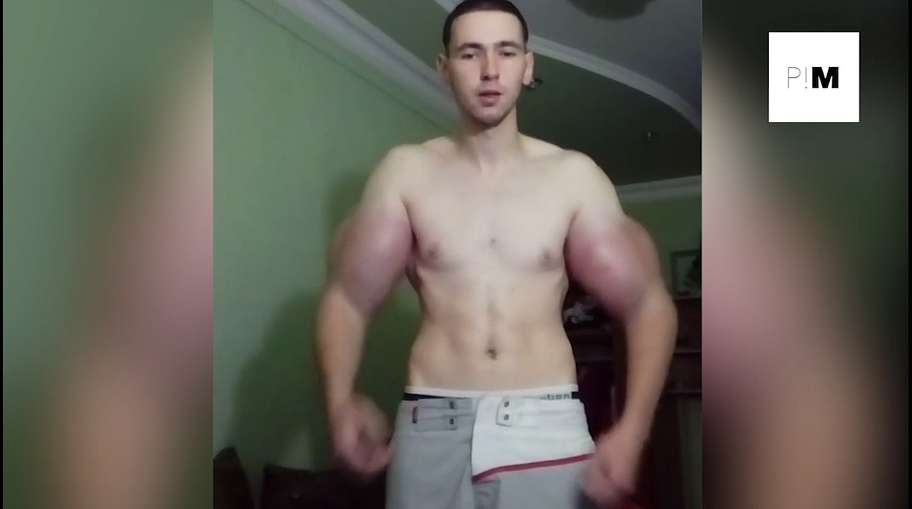 Le Popeye russe se fait gonfler les biceps en injectant de l'huile, du synthol
