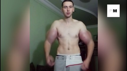 Le Popeye russe se fait gonfler les biceps en injectant de l'huile, du synthol