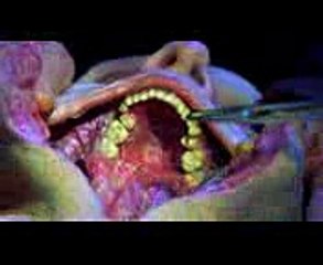 Blade II (2002) — The Autopsy (1016)