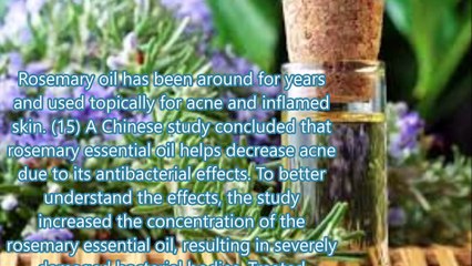 8 Natural Remedies How to Get Rid of Pimples 2017 HD YOUTUBE