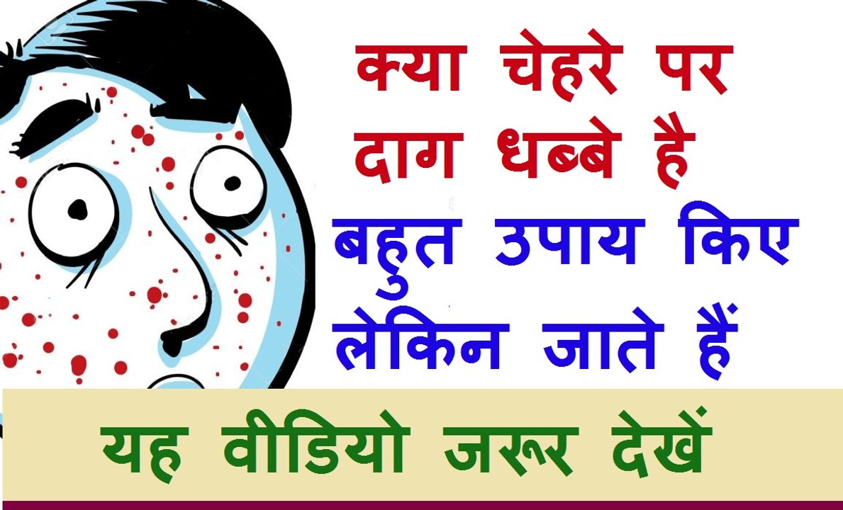 चेहरे के दाग धब्बे दूर करने का परमानेंट उपचार – Dark spots home remedies
