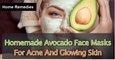 Moisturising Avocado Face Mask - Homemade Avocade Face Masks For Acne & Glowing Skin - Home Remedies