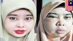 Wajah wanita rusak karena krim pemutih wajah - TomoNews