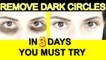 Remove Dark Circles Permanently - Remove Dark Circles in 3 Days - You Must Try