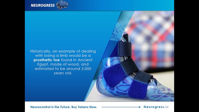 Neuro-controlled prosthetic limbs are here and they are better than anything on the market yet