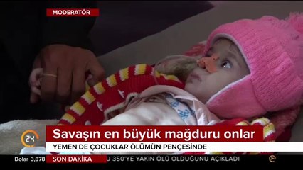 Savaşın en büyük mağduru çocuklar