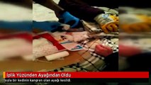 İplik Yüzünden Ayağından Oldu