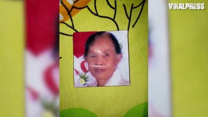 Grandmother's Face Destroyed By Sinusitis That Turned Into Tumour