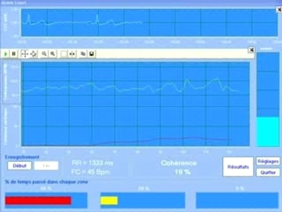 La cohérence cardiaque par SYMBIOFI : module expert