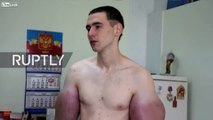Oh puh-lease, Hercules: 21-year-old Russian grows FOOT WIDE biceps after drug injections