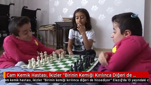 Cam Kemik Hastası, İkizler Birinin Kemiği Kırılınca Diğeri de Hissediyor