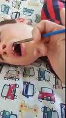 Calmer une crise d'épilepsie avec.. de l'huile de cannabis !