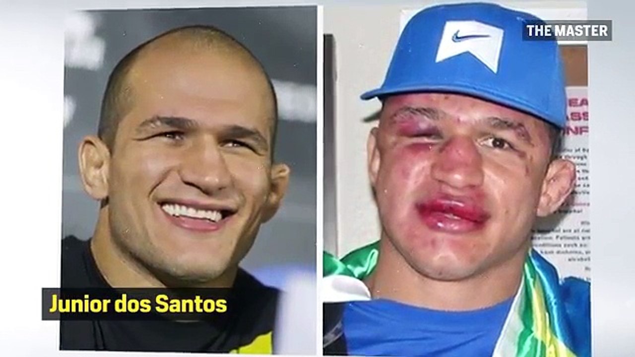 14 Brutal Before And After Photos Of UFC Fighters That Are Hard To See