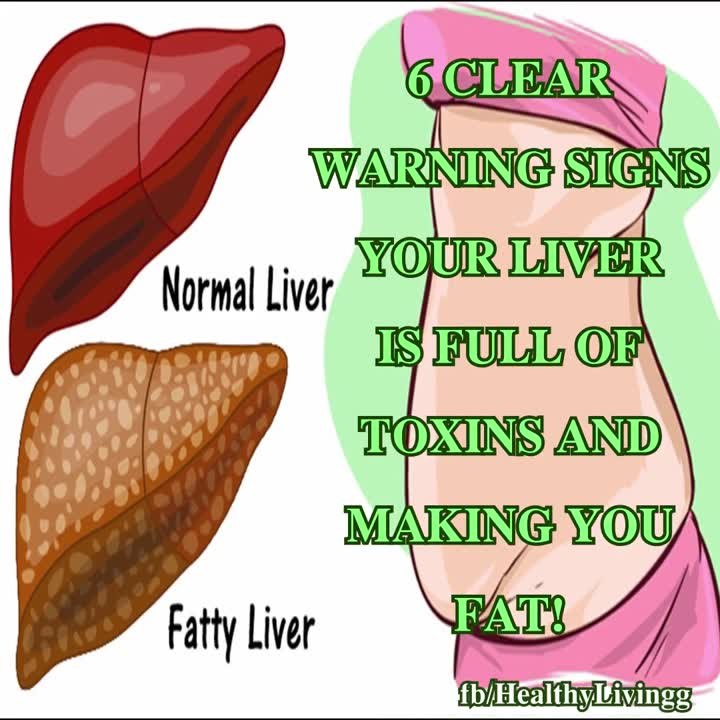 6 Signs That Your Liver Is Full of Toxins And Making You Fat
