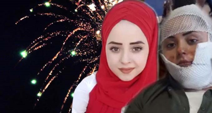 Asker Eğlencesinde Dehşet! Havai Fişek, Genç Kızın Yüzünde Patladı