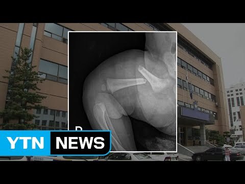 생후 50일 딸 학대 혐의로 20대 친부 수사 / YTN (Yes! Top News)