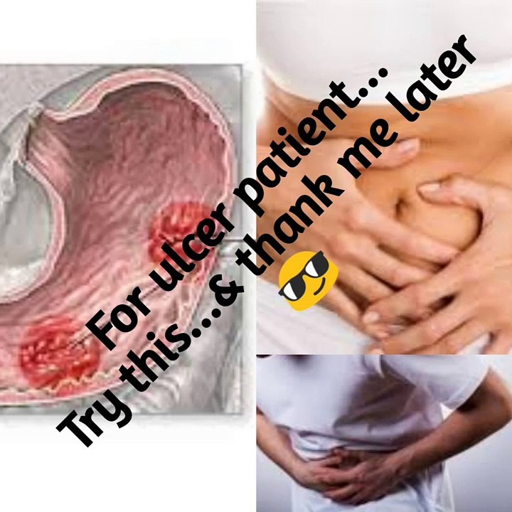 2 Best Home Remedy to Curing Stomach Ulcer and Peptic Ulcer.