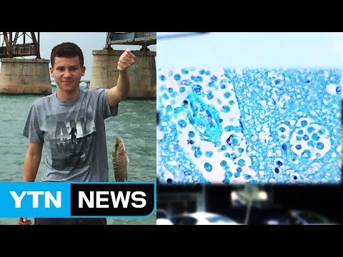 16살 미 소년, 뇌 먹는 아메바 걸렸다가 극적 생존 / YTN (Yes! Top News)