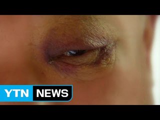 [단독] "문 닫아주세요" 한 마디에 주먹질 당한 경비원 / YTN (Yes! Top News)