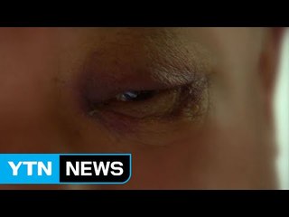 [단독] "문 닫아주세요" 한 마디에 폭행당한 경비원의 눈입니다 / YTN (Yes! Top News)