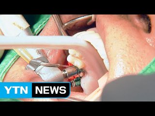 노년층 임플란트, 우선 '잇몸뼈 상태' 확인하세요! / YTN (Yes! Top News)