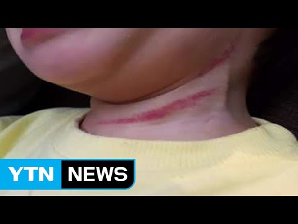 18개월 원아 멱살 잡고 흔들어" 학대 수사 / YTN (Yes! Top News)