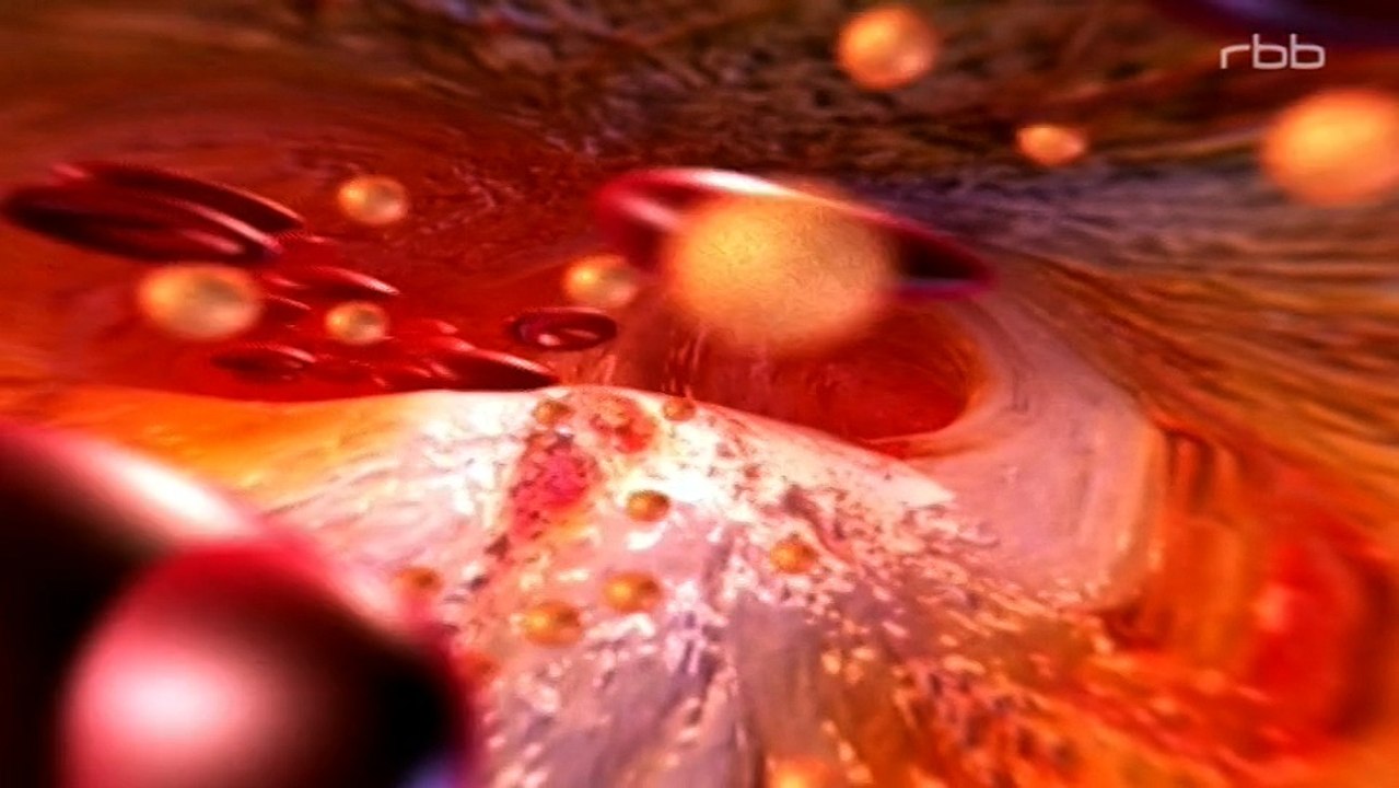 Gesund durch Sport: Der Krankheit davonlaufen [[Dokumentation]]