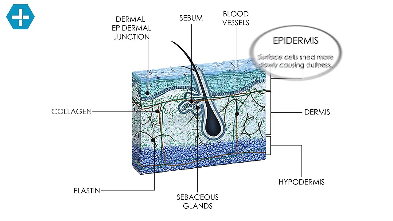 Skin Conditions - Age Spots