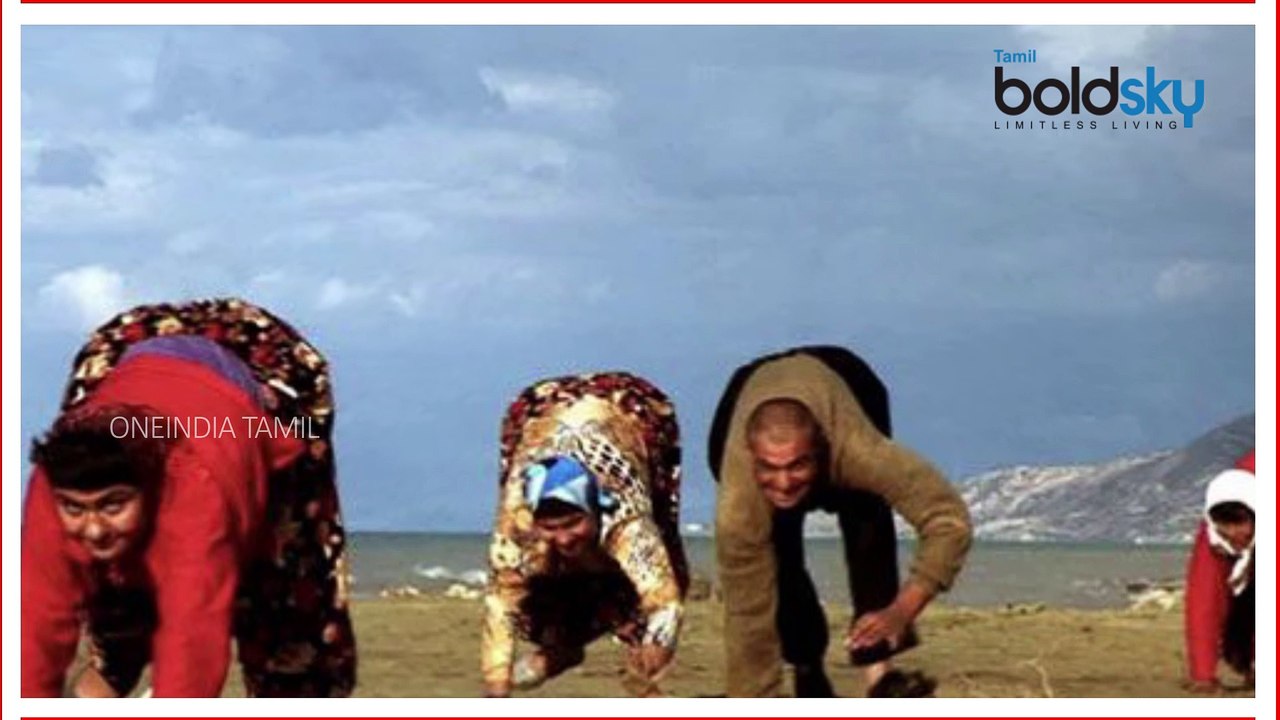 உலகின் உடல் அமைப்பு கோளாறுடன் பிறந்து, வாழ்ந்து, மடிந்த சில வித்தியாசமான மனிதர்கள்- வீடியோ