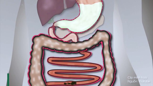 Vì sao chúng ta khó giải quyết chuyện tế nhị mỗi khi xa nhà