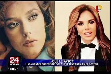 Lucía Méndez se sincera sobre las cirugías que se ha hecho