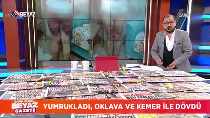 ''İhanet Şüphesi'' ile karısını bu hale getirdi