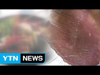 [단독] 펄펄 끓는 찌개 끼얹어 온몸에 화상입힌 20대 여성 / YTN