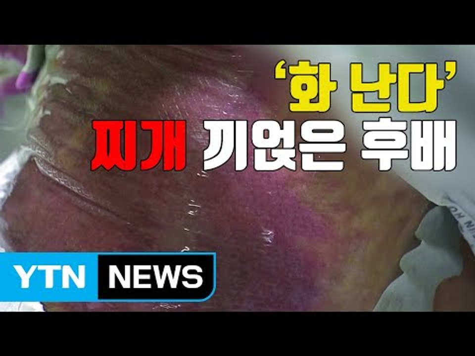 [자막뉴스] '화가 난다' 펄펄 끓는 찌개 끼얹은 후배 / YTN